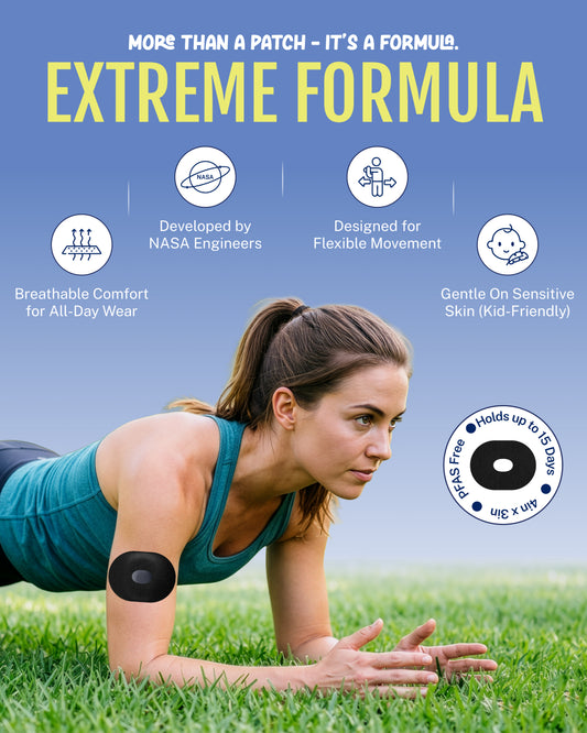 Extreme - Eversense 365 Adhesive Patches - Black (20 Pack)